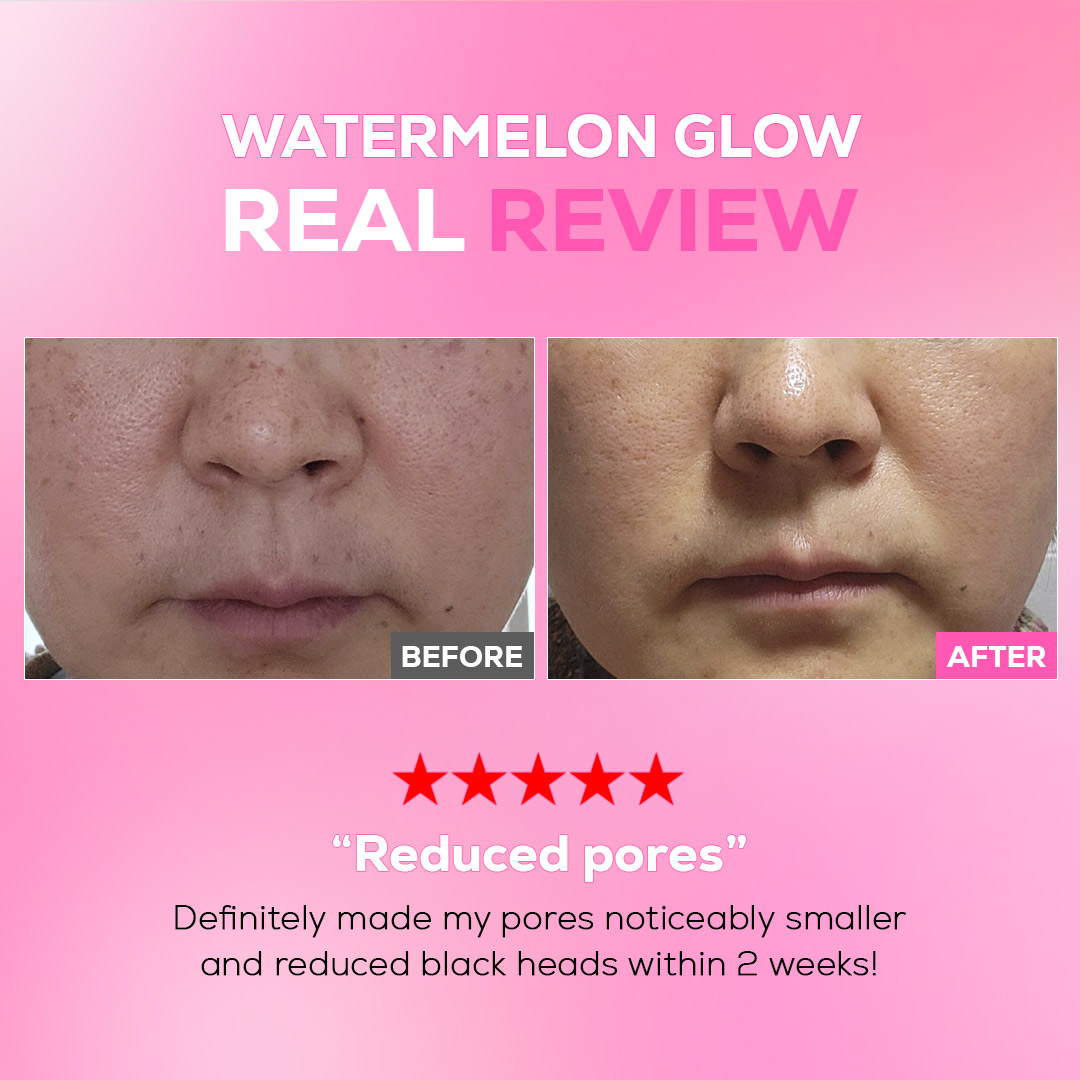 Watermelon Calming Glow Boosting Toner - Image 7